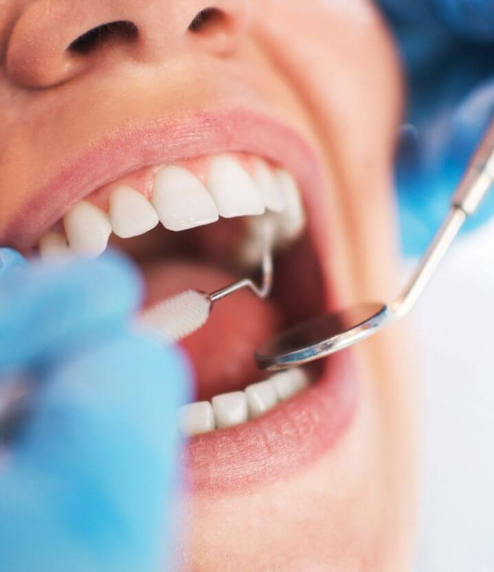 Open mouth with white teeth