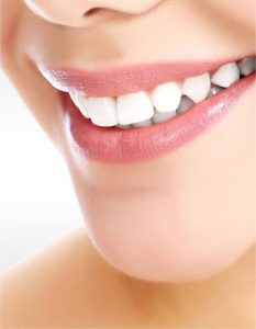Teeth Whitening smile woman